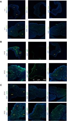 Transcriptomic analysis of the upper lip and primary palate development in mice